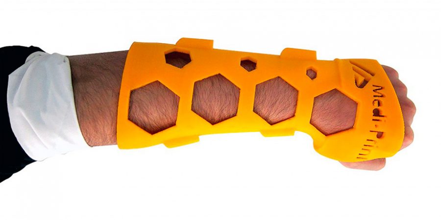 Emprendedores aplican impresión 3D en la medicina